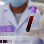 IPROSS acompañó a 15 afiliados en tratamientos de trasplante de médula ósea